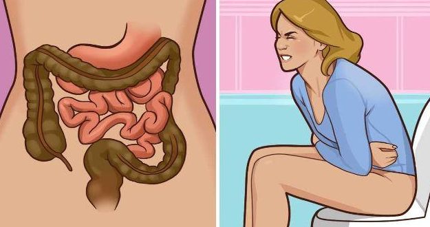 Thay Đổi Trong Thói Quen Đại Tiện